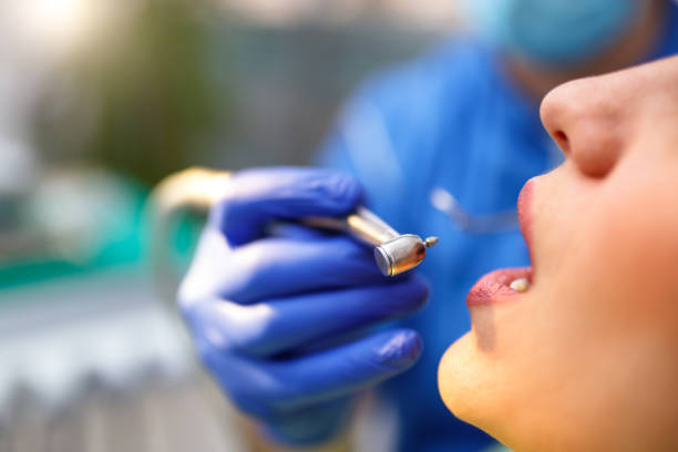 Dental Bonding in Carrollton, AL